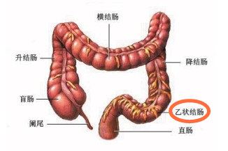 乙状结肠炎怎么治?